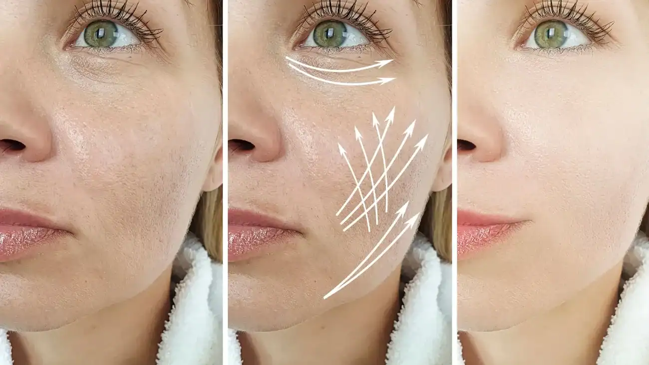 Can One Treatment Really Tackle More Than One Skin Concern Berkhamsted?