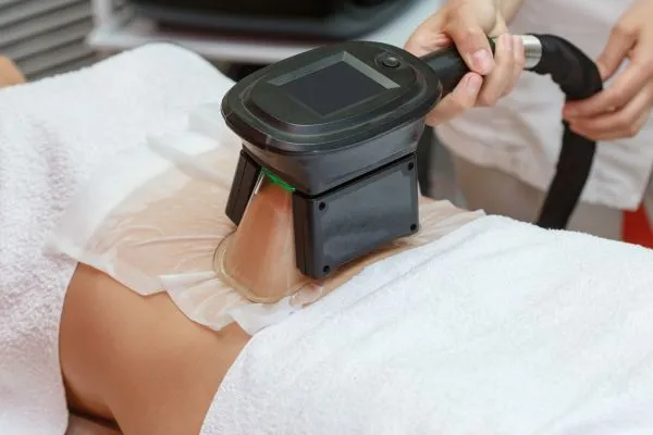 Image of person having fat freezing treatment to help weight gain Berkhamsted