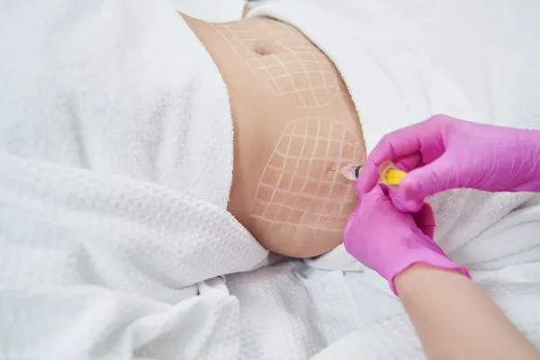 image of fat dissolving injections on love handles to help combat weight gain Berkhamsted