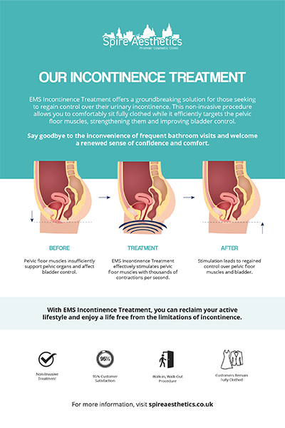 image to show how EMS treatment works for female urinary incontinence Berkhamsted