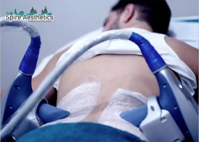 Man having fat freezing treatment done on love handles before a competitions Berkhamsted to create a sculpted look.