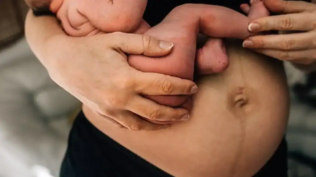 Why Is My Stomach Still Big After Pregnancy Berkhamsted?